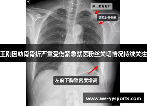 王刚因肋骨骨折严重受伤紧急就医粉丝关切情况持续关注